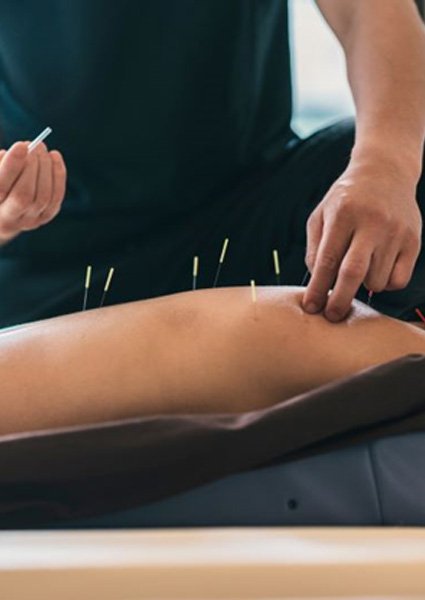 Medical professional administering acupuncture treatment 