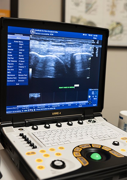 Diagnostic images from musculoskeletal ultrasound